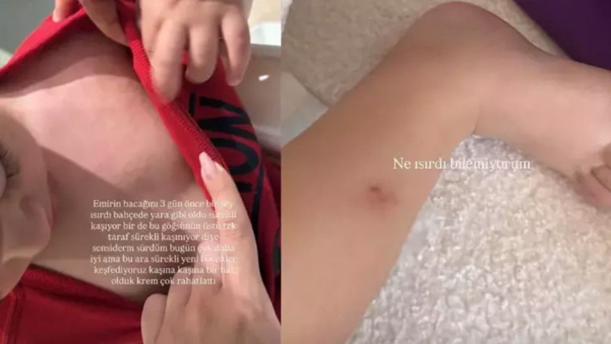 İdo Tatlıses ve Yasemin Şefkatli'nin İkizleri Hakkında Yaşananlar ve Sağlık Gündemi